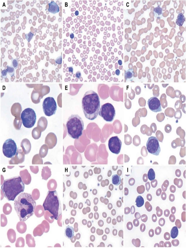 รายการ 105+ ภาพ leukocytes ในปัสสาวะ สวยมาก